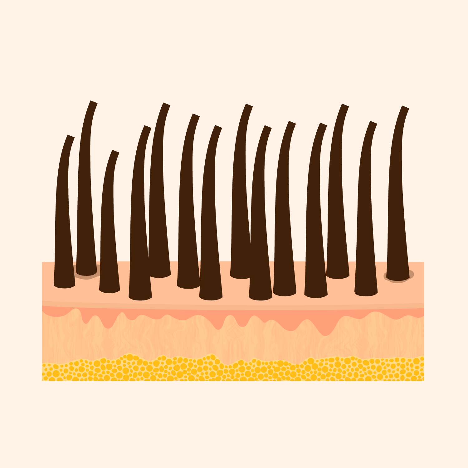 Dunkle dicke Haare Alexandrit